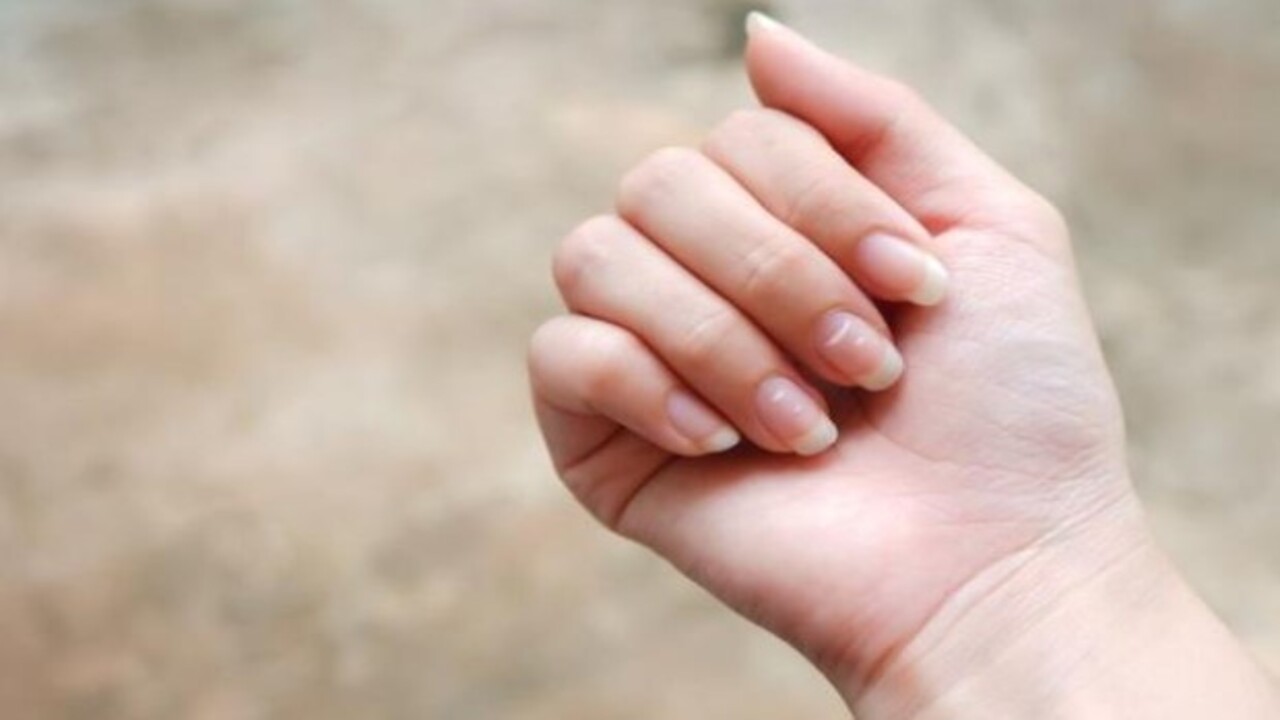 Foto - Bu hastalığın habercisiymiş! Tırnağınızda beyaz lekeler varsa dikkat