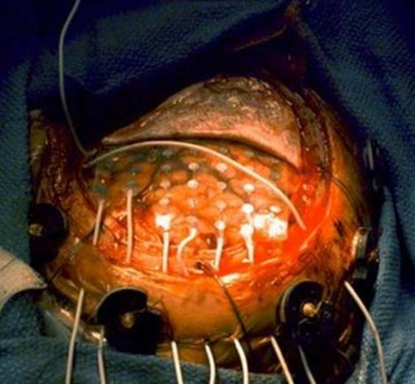 Foto - Bu hastalığın şifası 'dayak'