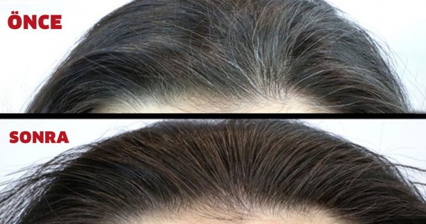 Foto - Bu içecek ile beyaz saça elveda deyin! Şok eden 3 diş malzeme ilaç yerine doğal aday! Birçok kişi dahil etti