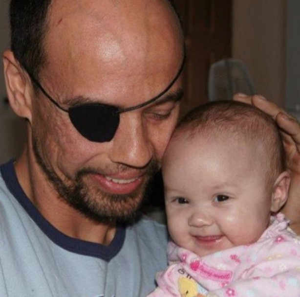 Bu insanların başına gelenlere çok şaşıracaksınız!