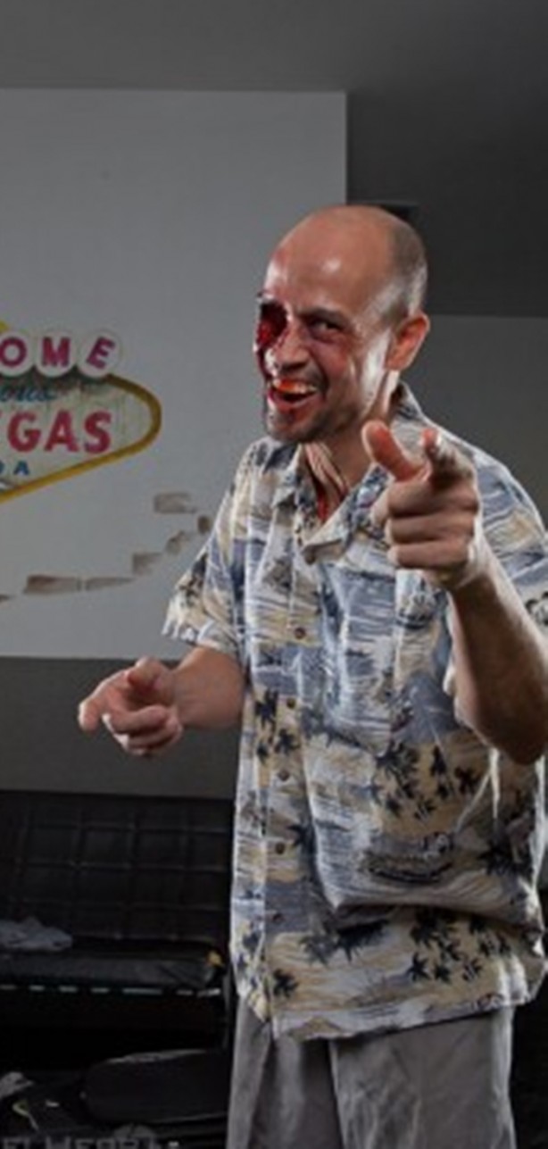 Foto - Bu insanların başına gelenlere çok şaşıracaksınız!