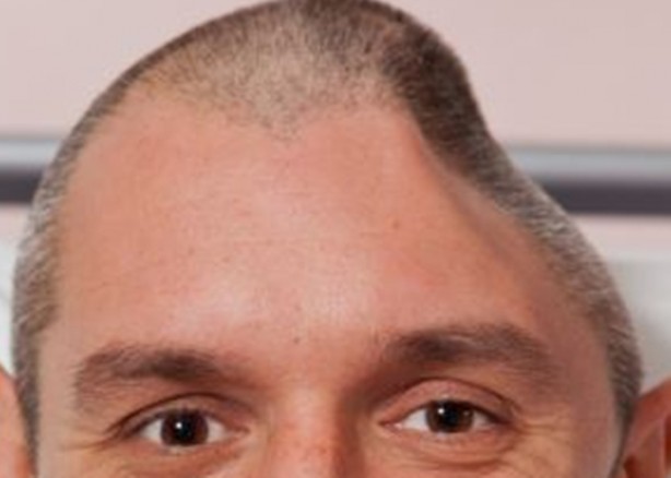 Foto - Bu insanların başına gelenlere çok şaşıracaksınız!