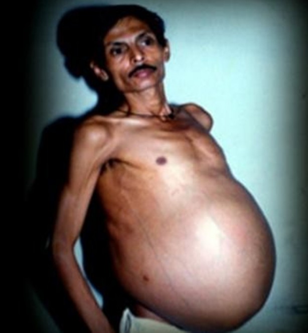 Foto - Bu insanların başına gelenlere çok şaşıracaksınız!