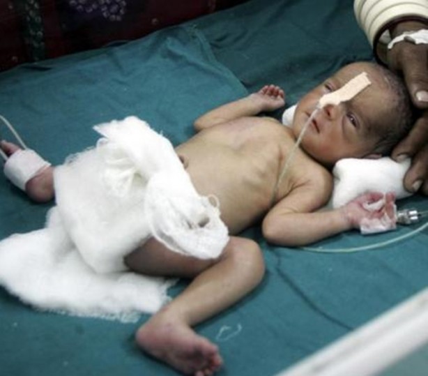 Foto - Bu insanların başına gelenlere çok şaşıracaksınız!