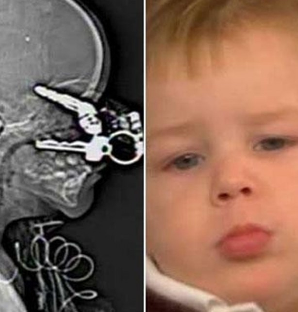 Foto - Bu insanların başına gelenlere çok şaşıracaksınız!