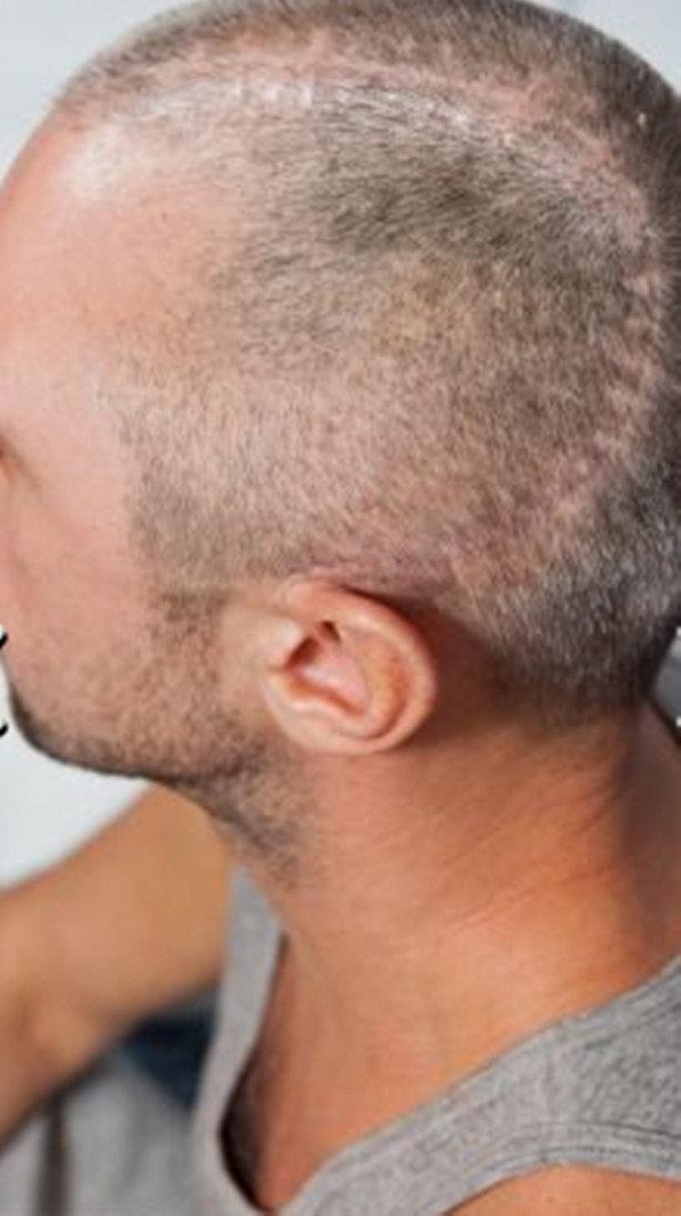 Foto - Bu insanların başına gelenlere çok şaşıracaksınız!