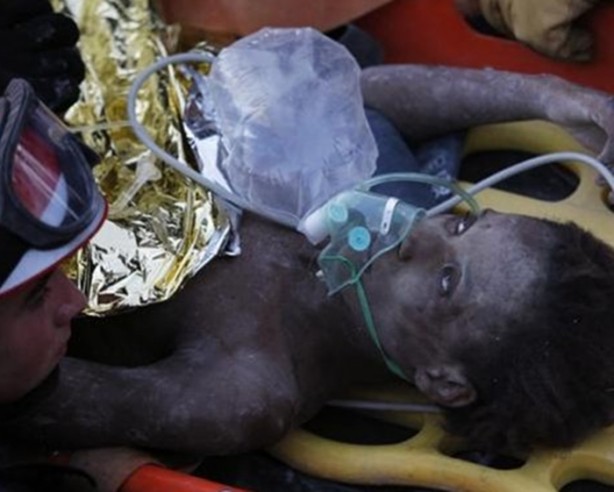 Foto - Bu insanların başına gelenlere çok şaşıracaksınız!