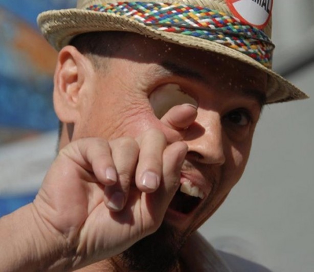 Foto - Bu insanların başına gelenlere çok şaşıracaksınız!