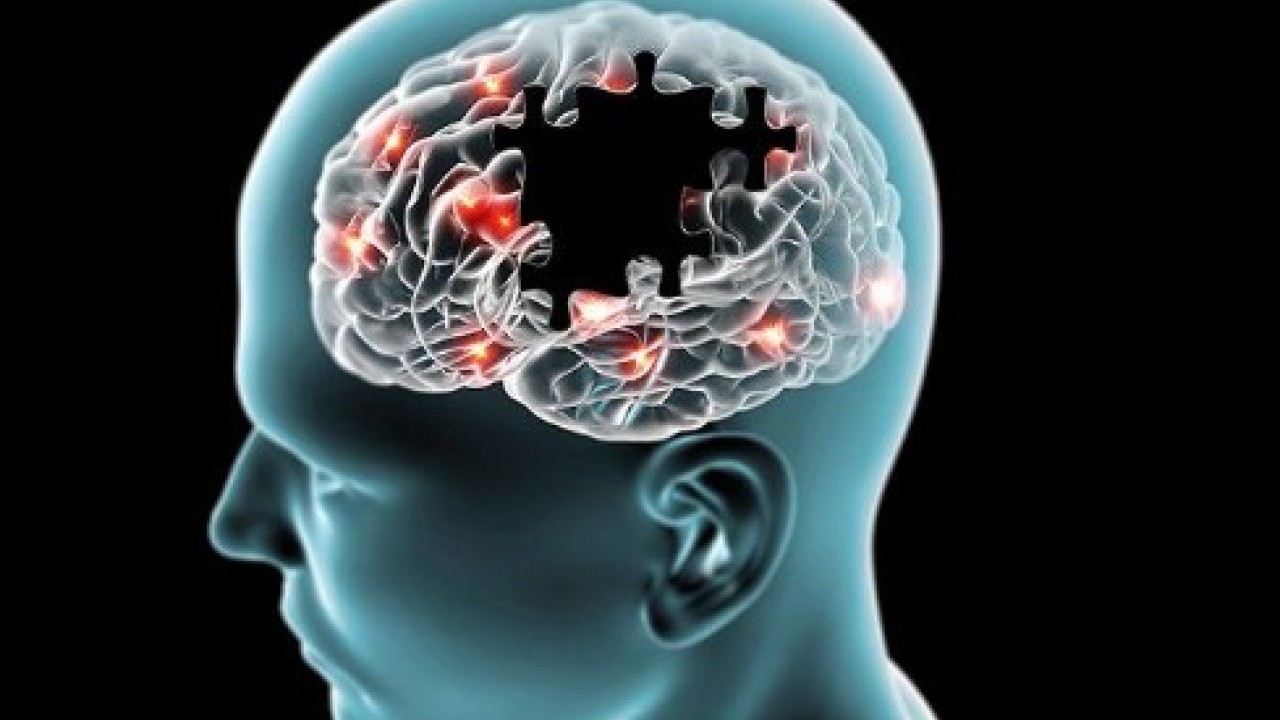 Bu işaretleri sakın hafife almayın: İşte Alzheimer'ın erken belirtileri!