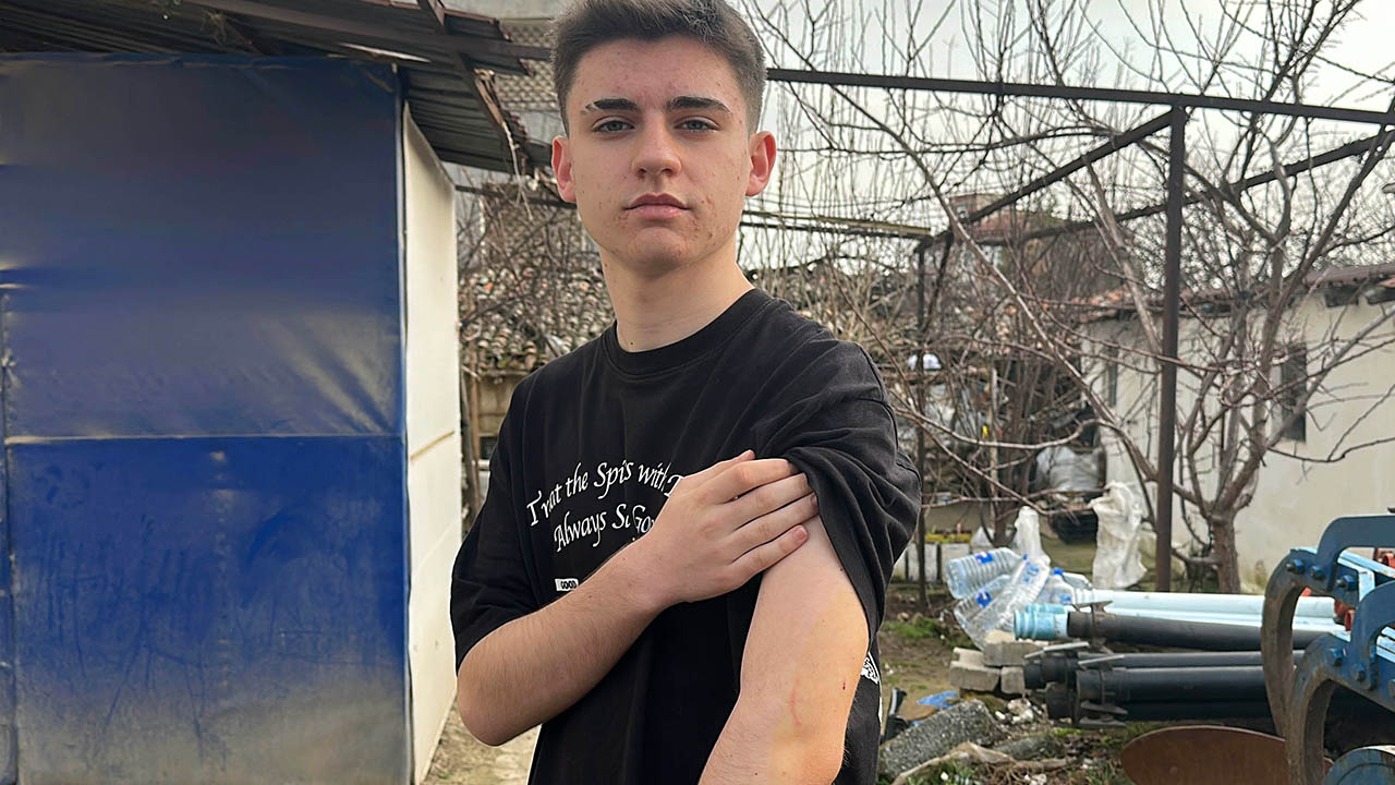 Foto - Bu işin sonu nereye varacak? Okula giden öğrenciye köpek saldırdı