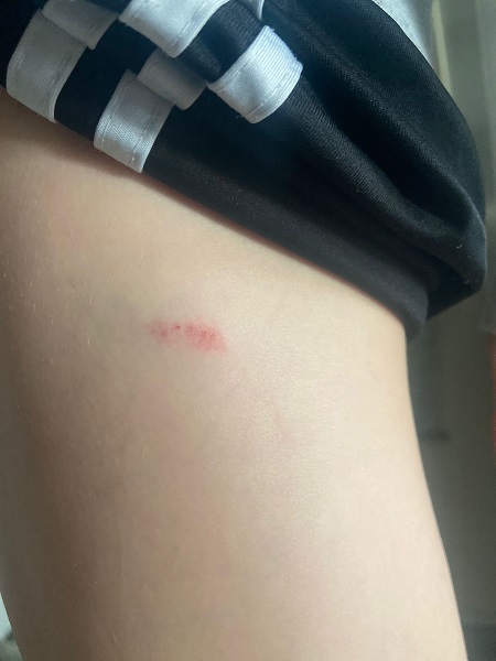 Foto - Bu işin sonu nereye varacak? Şimdi de okulda başıboş köpek dehşeti