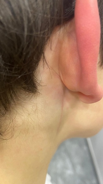 Foto - Bu işin sonu nereye varacak? Şimdi de okulda başıboş köpek dehşeti