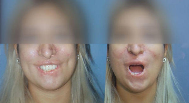 Foto - Bu kadar kolaymış deyip göze alıp yapanlar! Estetik uyarısı: Bakın vücudunuzda neler oluyor?