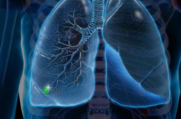 Foto - Bu kadar yıldır sigara içiyorsanız! Vay halinize…