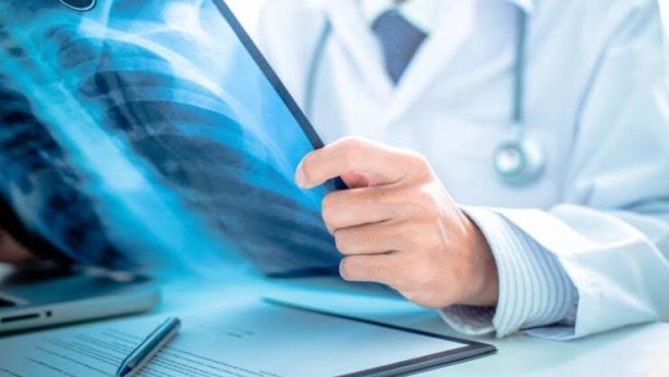 Foto - Bu kadar yıldır sigara içiyorsanız! Vay halinize…