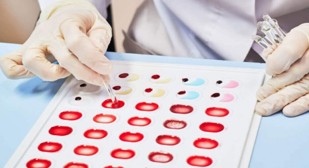 Foto - Bu kan grubuna sahip kişilerin hafızası çok zayıf! Dün ne yediklerini bile hatırlamıyorlarmış