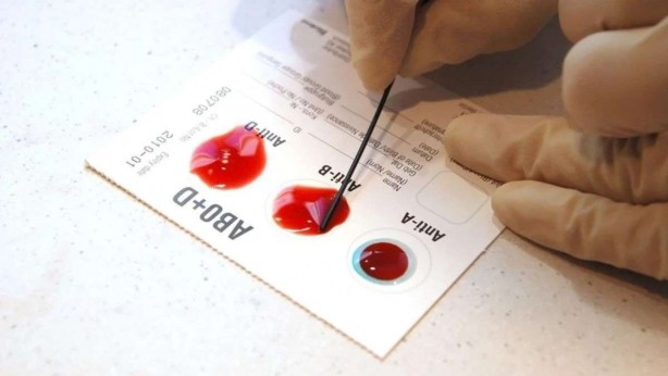 Foto - Bu kan grubundan olanlar adeta çakı gibi! Hastalık onların yanına bile uğramıyor! Bilimsel araştırmayla kanıtlandı