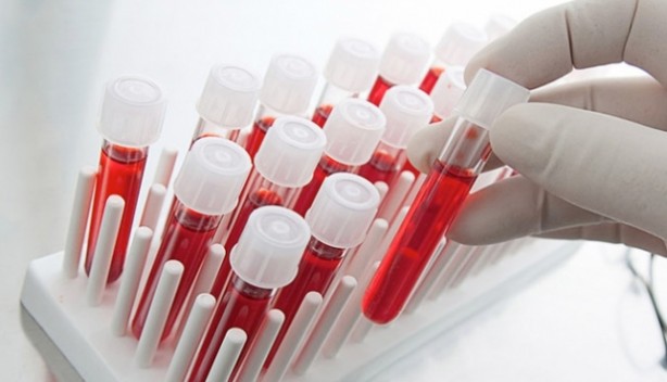 Foto - Bu kan grubundan olanlar adeta çakı gibi! Hastalık onların yanına bile uğramıyor! Bilimsel araştırmayla kanıtlandı