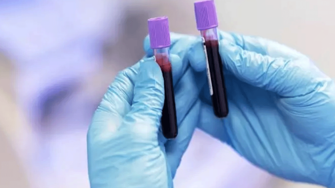 Foto - Bu kan grubundan olanlar dikkat: Kansere en çok yakalanan kan grubu belli oldu!