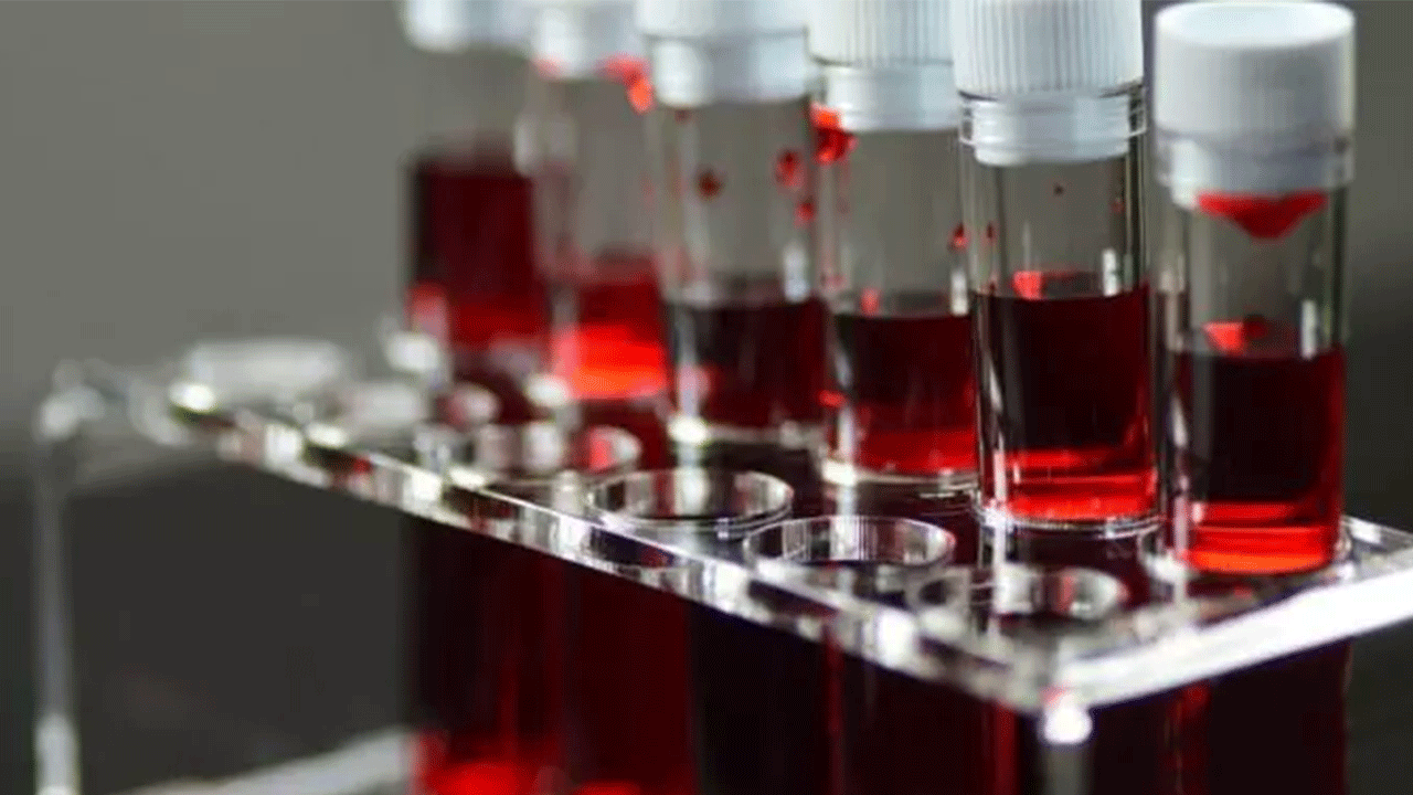 Foto - Bu kan grubundan olanlar dikkat: Kansere en çok yakalanan kan grubu belli oldu!