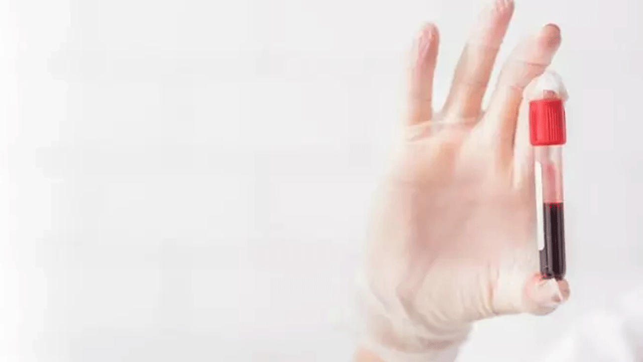 Foto - Bu kan grubundan olanlar dikkat: Kansere en çok yakalanan kan grubu belli oldu!