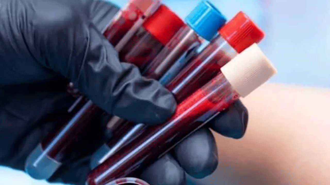 Foto - Bu kan grubundan olanlar dikkat: Kansere en çok yakalanan kan grubu belli oldu!