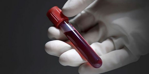 Foto - Bu kan grubundaysanız, kalp krizi riskiniz yüksek