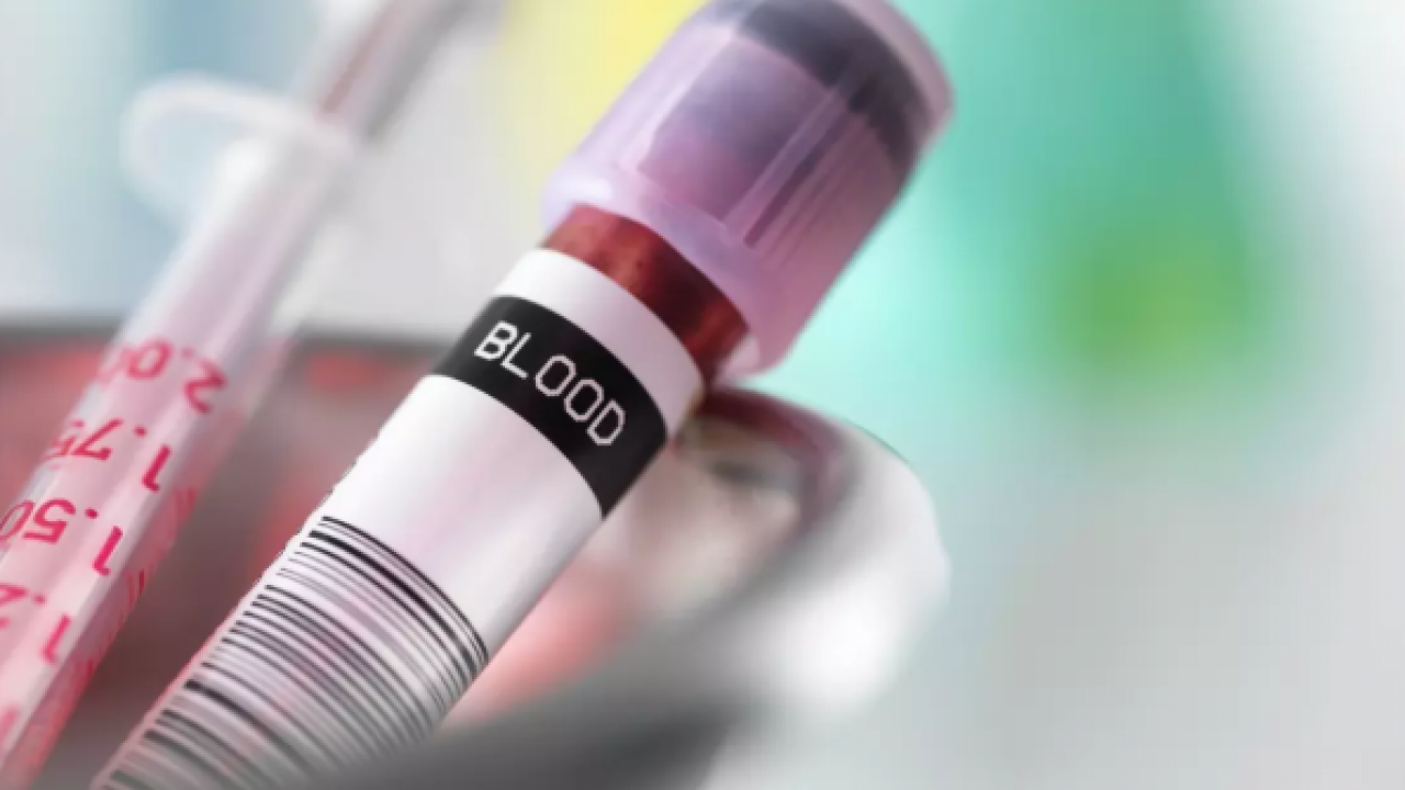 Diyabete en yatkın kan grubu belli oldu! Bilim insanları açıkladı!