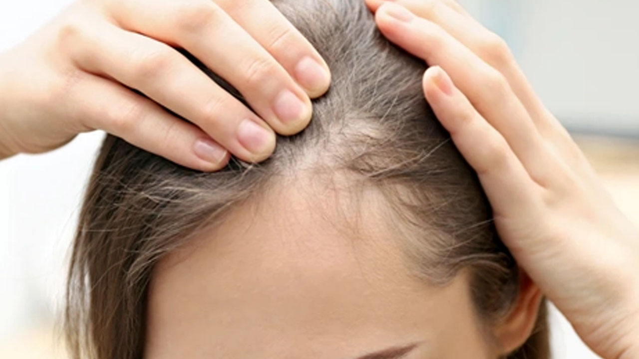 Bu karışım sayesinde saçınız artık hiç beyazlamayacak! Ünlü ilaçlara rakip oluyor!