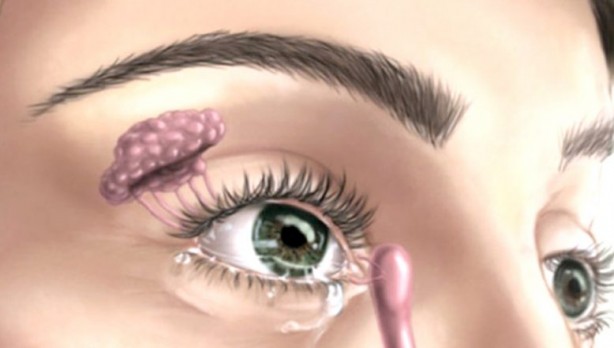 Foto - Bu kişilerde daha sık görülüyor: Göz kuruluğunun altında ne yatıyor?