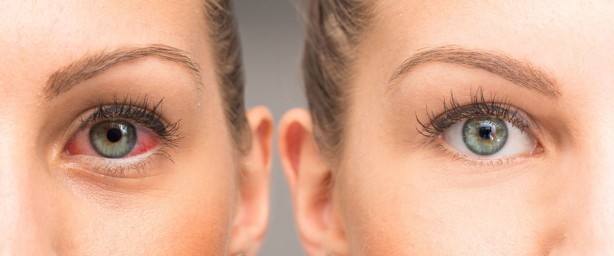 Foto - Bu kişilerde daha sık görülüyor: Göz kuruluğunun altında ne yatıyor?