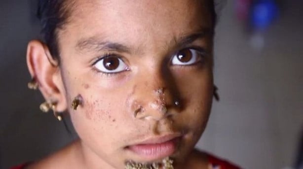 Foto - Gün geçtikçe ağaca dönüşüyor!