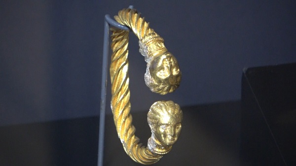 Foto - Bu müzenin örneği çok az! 5 bin yıl önce beyin ameliyatı yapılmış