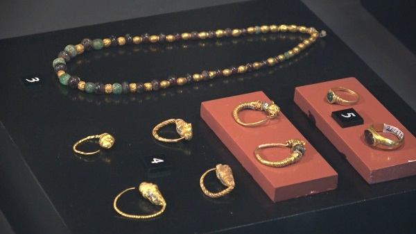 Foto - Bu müzenin örneği çok az! 5 bin yıl önce beyin ameliyatı yapılmış