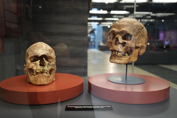 Bu müzenin örneği çok az! 5 bin yıl önce beyin ameliyatı yapılmış