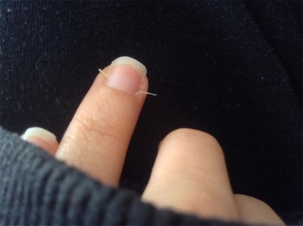 Foto - Bu pratik bilgiler hayat kurtarıyor