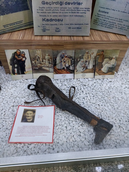 Foto - Bu protez görenleri ağlatıyor