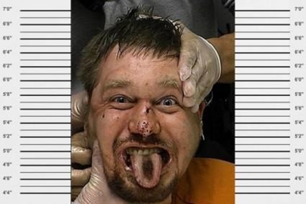 Foto - Bu sabıka fotoğrafları kabusunuza girecek cinsten