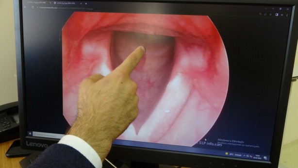 Foto - Bu sorun sizde de olabilir Sesiniz giderek kısılıyorsa dikkat!