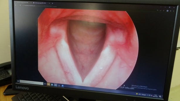 Foto - Bu sorun sizde de olabilir Sesiniz giderek kısılıyorsa dikkat!