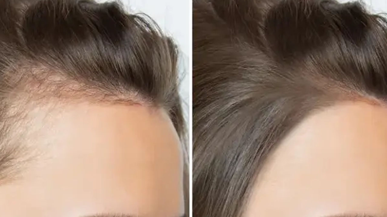 Foto - Bu tarifle çok daha güzel saçlarınız olacak!