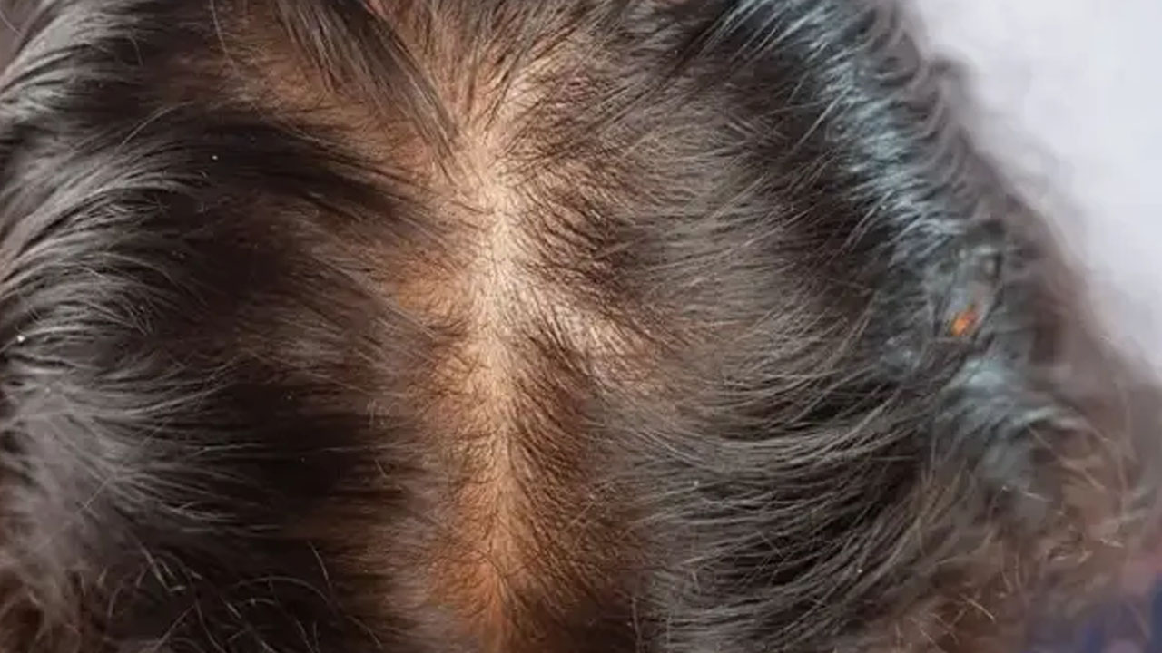 Foto - Bu tarifle çok daha güzel saçlarınız olacak!