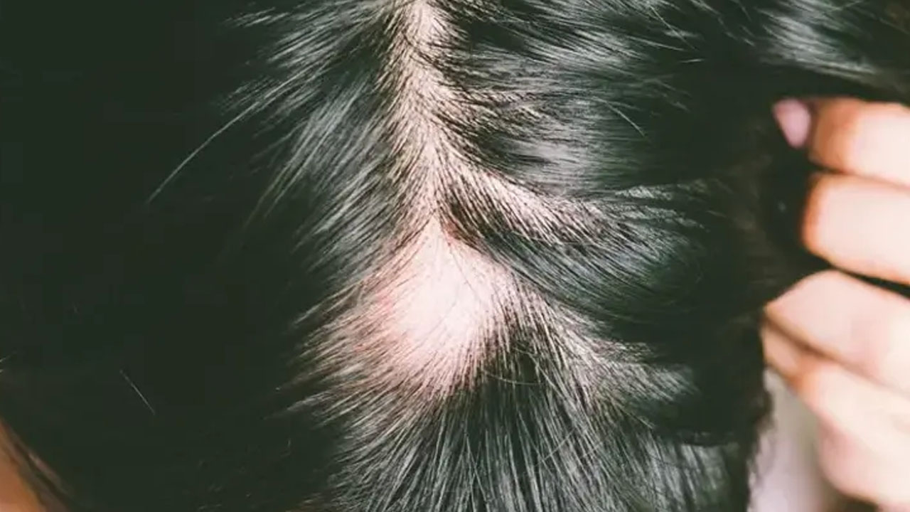 Foto - Bu tarifle çok daha güzel saçlarınız olacak!