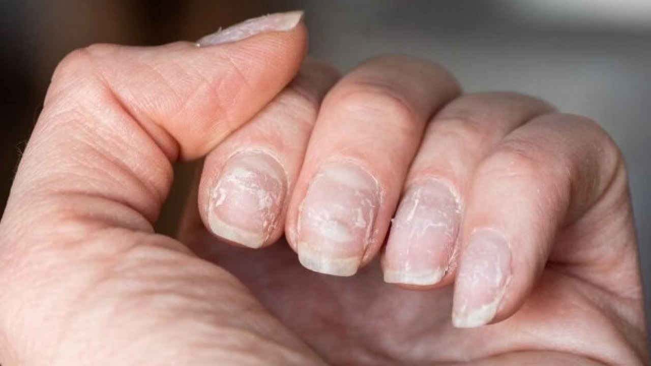 Foto - Bu üç hastalığın habercisi olabilir! Tırnaklarınız sürekli kırılıyorsa dikkat