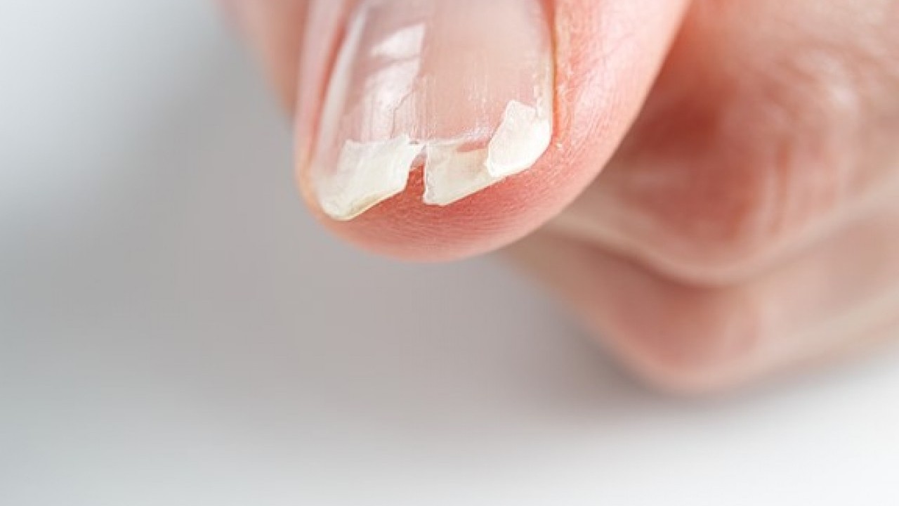 Bu üç hastalığın habercisi olabilir! Tırnaklarınız sürekli kırılıyorsa dikkat