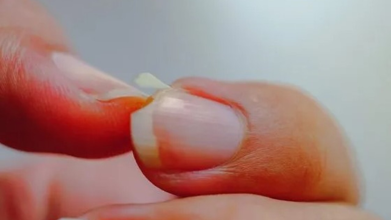 Foto - Bu üç hastalığın habercisi olabilir! Tırnaklarınız sürekli kırılıyorsa dikkat