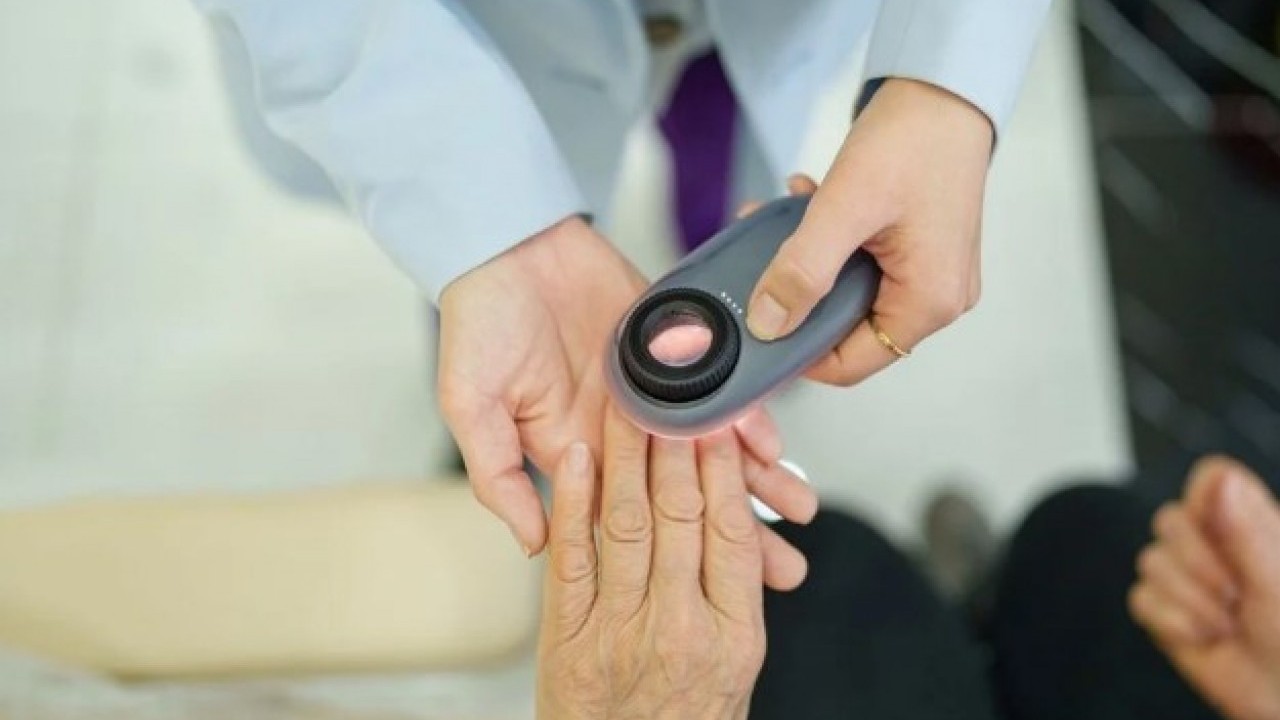 Foto - Bu üç hastalığın habercisi olabilir! Tırnaklarınız sürekli kırılıyorsa dikkat