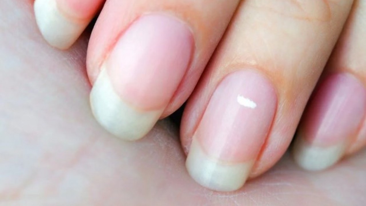 Foto - Bu üç hastalığın habercisi olabilir! Tırnaklarınız sürekli kırılıyorsa dikkat