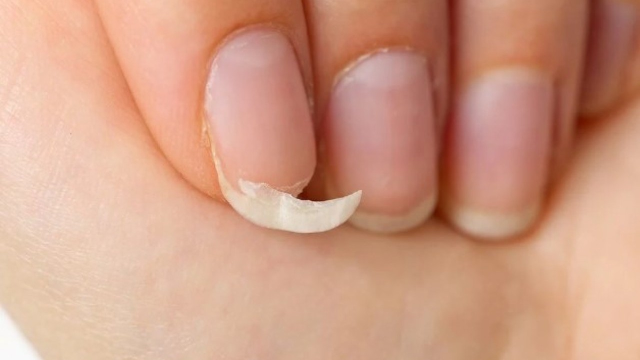 Foto - Bu üç hastalığın habercisi olabilir! Tırnaklarınız sürekli kırılıyorsa dikkat