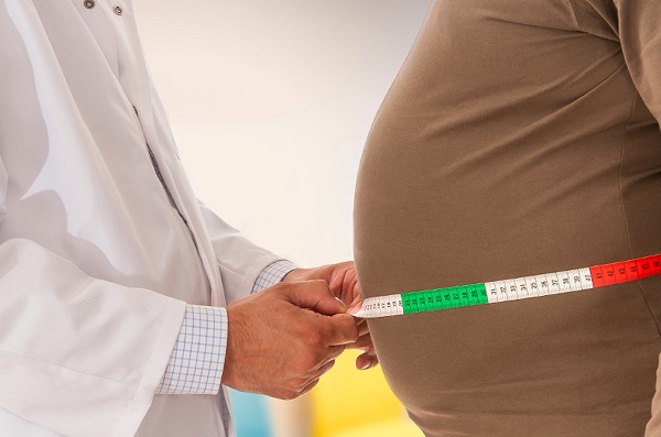 Foto - Bu ürünlerden uzak durun! İşte, obezitenin en büyük sebebi